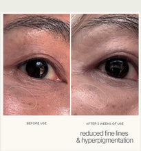 將圖片載入圖庫檢視器 DAMDAM Matcha boost eye serum (天然護膚)