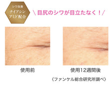 將圖片載入圖庫檢視器 Fancl 秋冬套裝(日本官網限定優先發售)