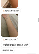 將圖片載入圖庫檢視器 好評日本濕疹護理優惠套裝