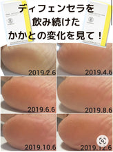 將圖片載入圖庫檢視器 歷時10年研發 ORBIS 神經酰胺保濕口服粉