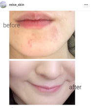 將圖片載入圖庫檢視器 REISE天然蛋殼膜保濕三層式導入化妝水