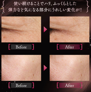 FANCL Advanced Beauty Concentrate最新外外泌體精華