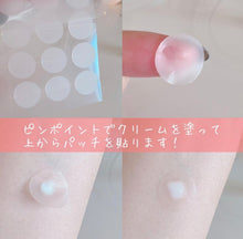 將圖片載入圖庫檢視器 Acnes labo夜用集中去印抗痘貼（黑色素/痘印/色斑￼）
