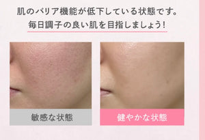 DR.CI:LABO城野醫生敏感肌保濕化妝水150ml