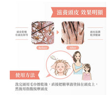 將圖片載入圖庫檢視器 Mama&amp;Kids 頭皮精華150ml(產後媽媽、兒童和男士都可使用)

